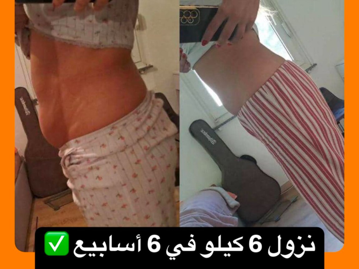 نتيجة قبل وبعد 9